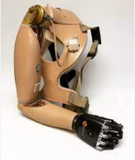 Shoulder-Disarticulation Prosthesis