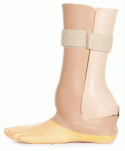Syme Prosthesis